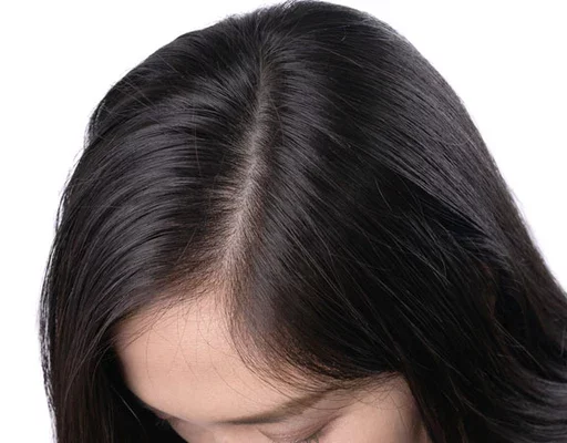 Accumulation de cuir chevelu : La vérité que vous devez savoir